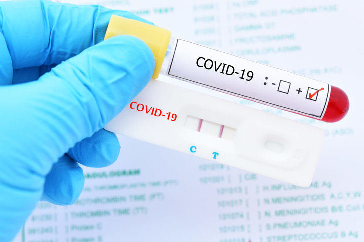 De 4.614 nuevos casos por infección de coronavirus detectados este miércoles en CLM, 545 son de Guadalajara